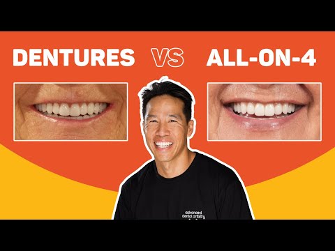 download lagu mp3 mp4 Fixed Vs Removable Dentures, download lagu Fixed Vs Removable Dentures gratis, unduh video klip Fixed Vs Removable Dentures