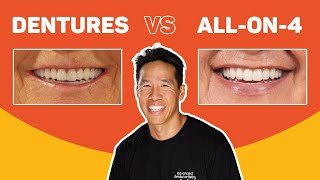 Dentures vs All-on-4