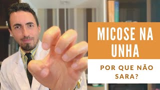 Micose de unha que não sara nunca Você precisa saber disso!