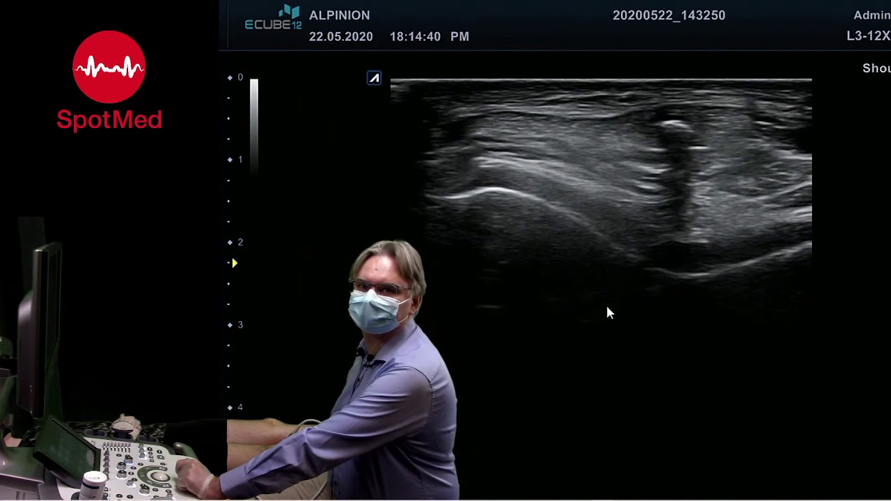 Webinar: USG stawu kolanowego