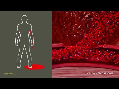 CELOX Rapid & CELOX Gauze Mode of Action