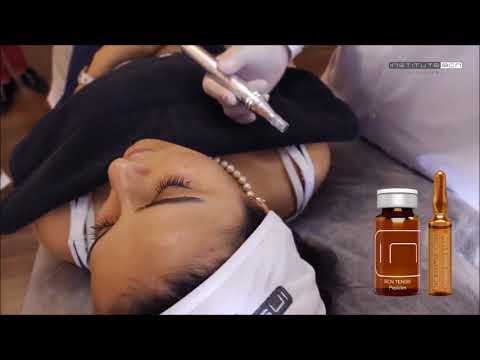 Tratamiento Reafirmante y Antienvejecimiento: BCN Peels & Mesoceuticals | Instituto BCN