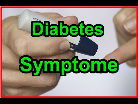 Drogerien von Moskau, wo Insulin ist Tabelle Blutzucker zu vergleichen