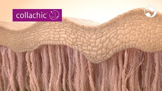 Collachic™ - a collagen-based solution supporting skin beauty from within.