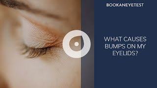 Bump on my Eyelid | Eyelid bump | What causes Bump On My Eyelids? | Book an eye test