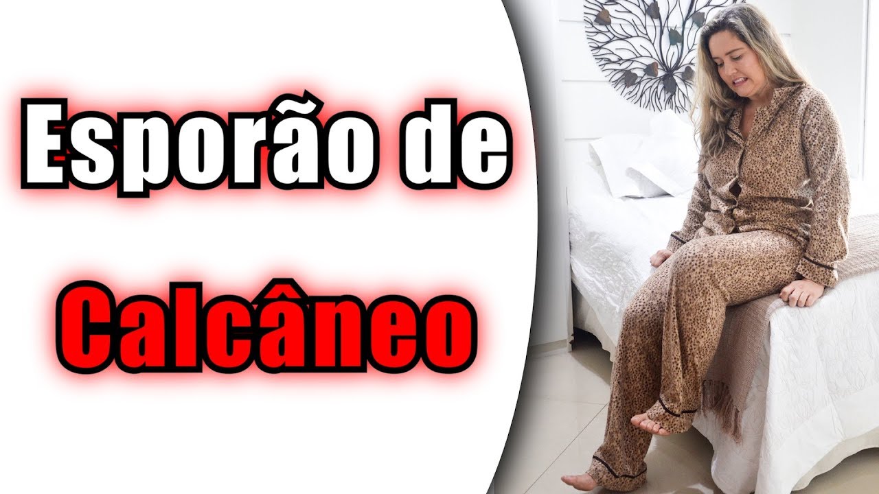 Dicas de Tratamento para Esporão de Calcâneo / Fascite Plantar - Aliviar a Dor