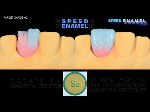 Noritake EX3 Translucent. Прозрачная масса 50гр T1 - фото 2 - id-p2887093511