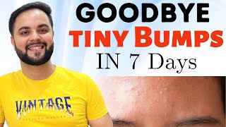 7 Days Clear Skin Challenge ||Clear Tiny Bumps from Forehead & Face