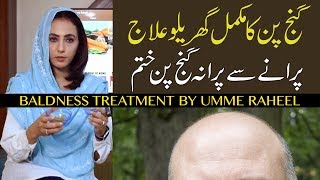 Ganjpan ka Asan Ilaaj || baal Ajainge || Baldness Treatment by Dr. Umme Raheel