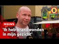 Oliebollenbakker zwaargewond na gasexplosie: 'Toch weer aan de slag' | Omroep Brabant