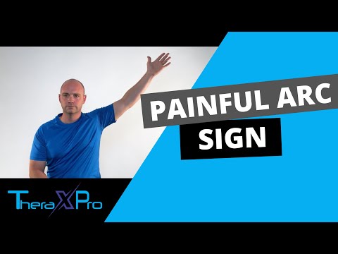 Painful Arc | Subacromial Pain Syndrome (SAPS)