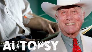 Larry Hagman: The Star Who Lived Big and Paid the Price | Our History