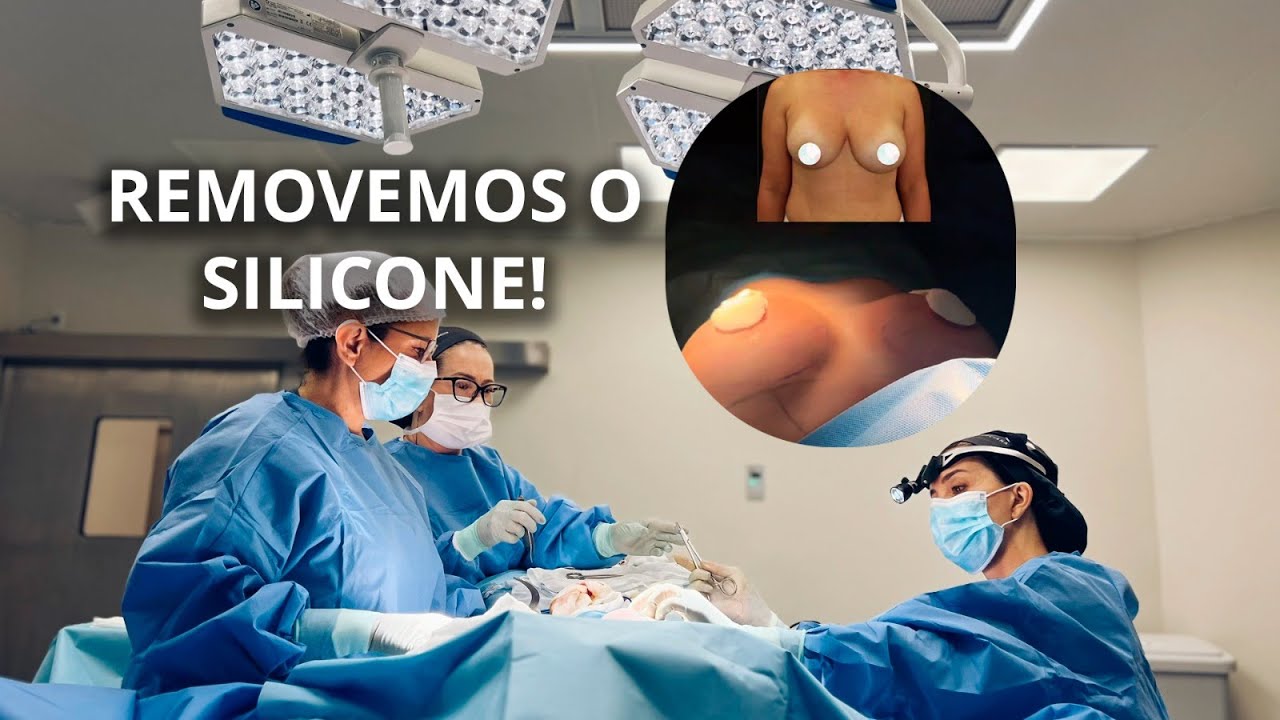 EXPLANTE DE PRÓTESES DE MAMA + ENXERTO DE GORDURA - VEJA O RESULTADO!