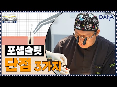 의느님답변????포셉슬릿 단점 3가지ㅣ포셉슬릿 왜 안 하나요?ㅣ다나성형외과(DANA)ㅣ모발이식ㅣ헤어라인교정ㅣ두피문신ㅣ탈모치료