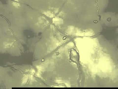 Zoospore release from sporangium