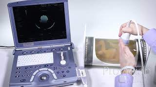4D Ultrasound Tutorial: Understanding 4D Imaging