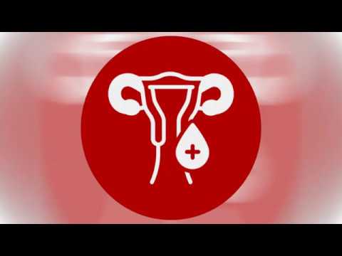 PPH - Peripartale Blutung - Ge