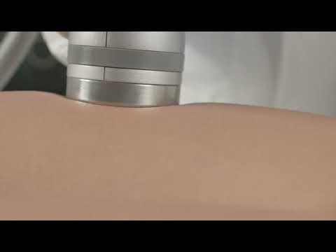 DEKA ONDA PLUS 一叮溶脂