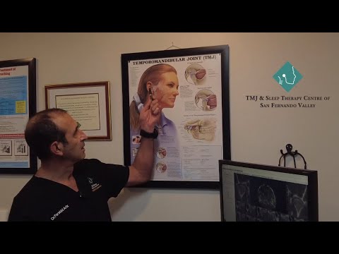 Video about TMJ and sleep treatment