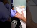 How to fix a trigger finger? #triggerfinger #painmanagement #painrelief
