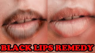 GET RID OF BLACK LIPS FROM SMOKING | LIP LIGHTENING HOME REMEDIES FOR DARK LIPS & BLACK CHAPPED LIPS