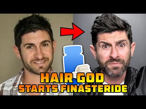 Density King Norwood 0 Hair God Alpha M. Starts Finasteride
