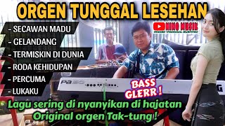 Download lagu ORGEN TUNGGAL LESEHAN TAK TUNG JADUL❗NINO MUSIK❗Secawan madu, Gelandangan, Lukaku, Percuma mp3 Download lagu ORGEN TUNGGAL LESEHAN TAK TUNG JADUL❗NINO MUSIK❗Secawan madu, Gelandangan, Lukaku, Percuma mp3