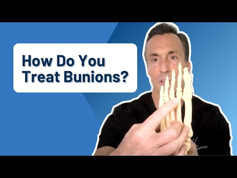 What is a Bunion Causes and Treatment Options