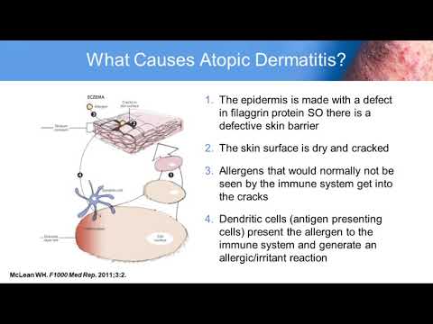 Atopic Dermatitis: Improving Outcomes in Adult and Pediatric Patients