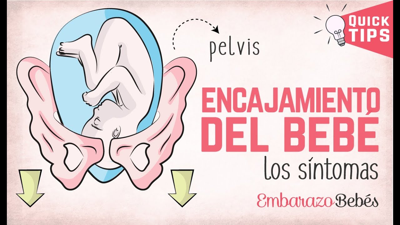 ENCAJAMIENTO del bebé 👶🏼⬇️ SÍNTOMAS