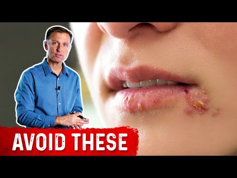 Shingles Natural Relief