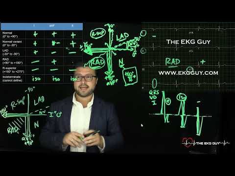 Determining axis simplified | The EKG Guy - www.ekgguy.com