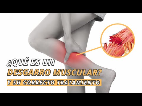 What is a muscle tear? | Symptoms and treatment