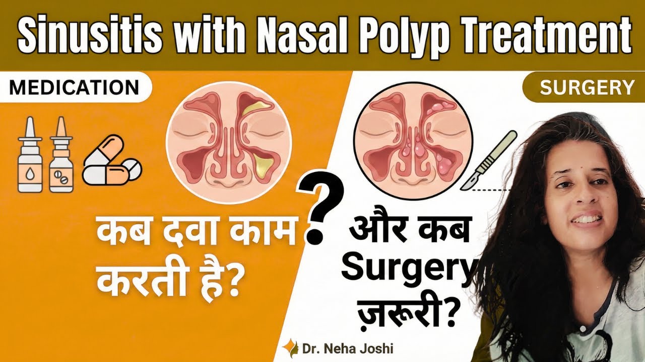 Sinusitis with Nasal Polyp Treatment | कब दवा काम करती है और कब Surgery ज़रूरी?