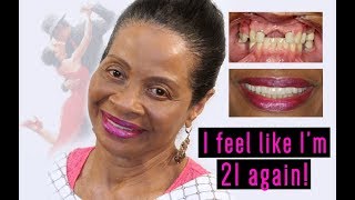 Complete Smile Makeover | Dental Implants at Envy Smile Dental Spa