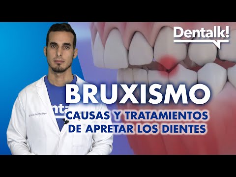All about BRUXISM - Symptoms, treatments and consequences of GRINDING teeth | Dentalk! ©