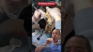 THIS IS UNREAL!😳#shorts #callus