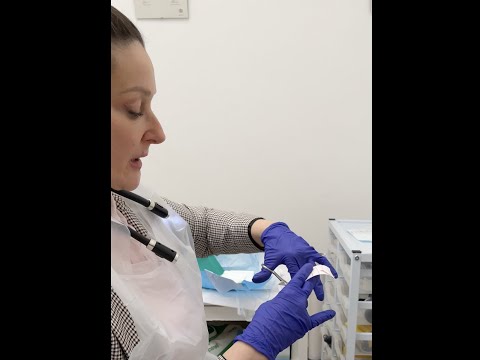 How to dress a toenail after it has received treatment 👣🩹