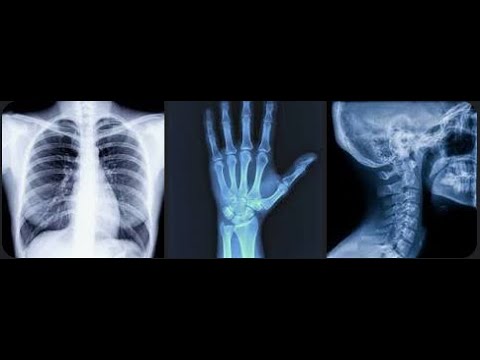 Complete Radiographic Anatomy - Part 1
