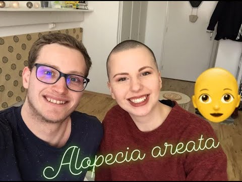 Férgek alopecia kezelése, A foltos hajhullás okai és kezelése