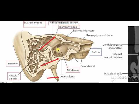Middle ear boundaries 2