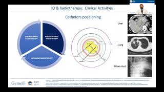 IO & Radiotherapy: towards a closer partnership? - Luca Tagliaferri