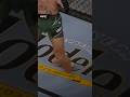 Conor McGregor Injury Shorts Ufc Mma