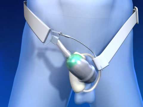 Acquistare a Rostov per aumentare la potenza Eccitatore per le donne in Krasnodar