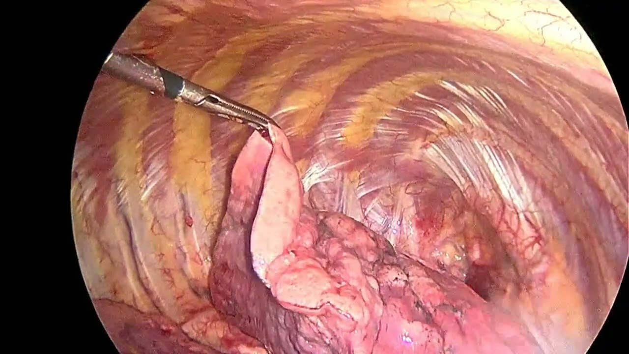 Mauro Boldrini Nascimbem-10