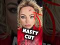 Liv Morgan SUFFERED A NASTY CUT On Raw