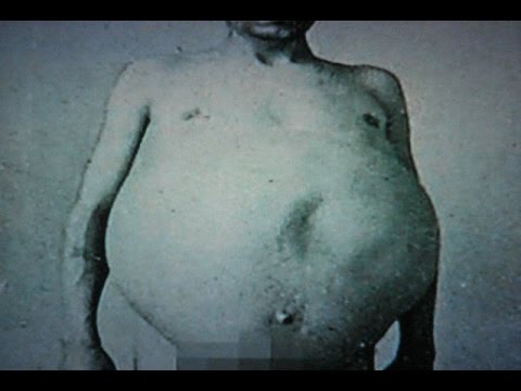 МУЖЧИНА НЕ ХОДИЛ В ТУАЛЕТ 13 ЛЕТ И ПОПАЛ В ИСТОРИЮ!
