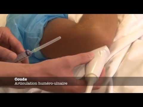 terapia viscerala cu varicoza tratament vase capilare sparte pe picioare