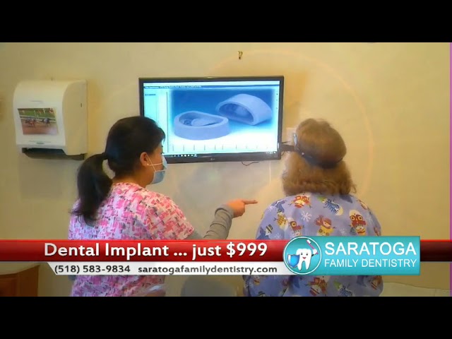 Saratoga Family Dentistry REV Implant $999