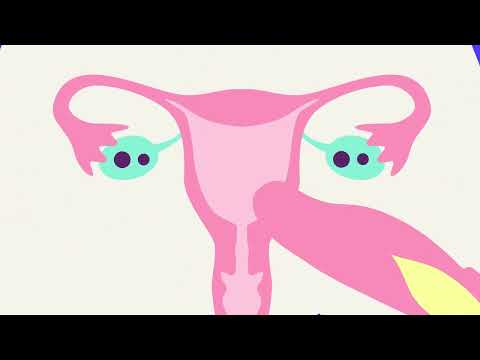 Hormonal and copper coils: How do they work?